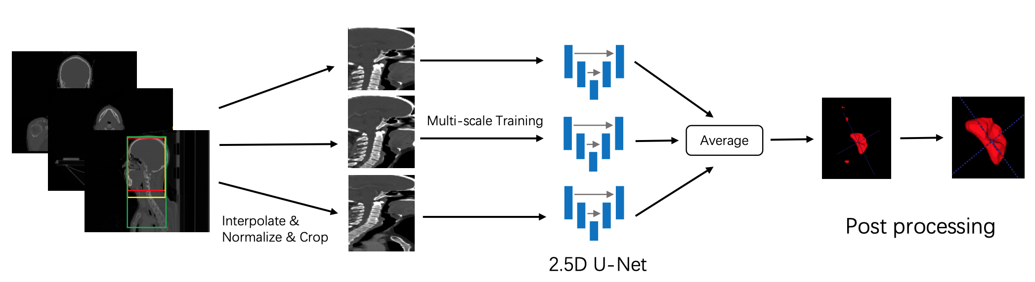 2.5D UNet Results